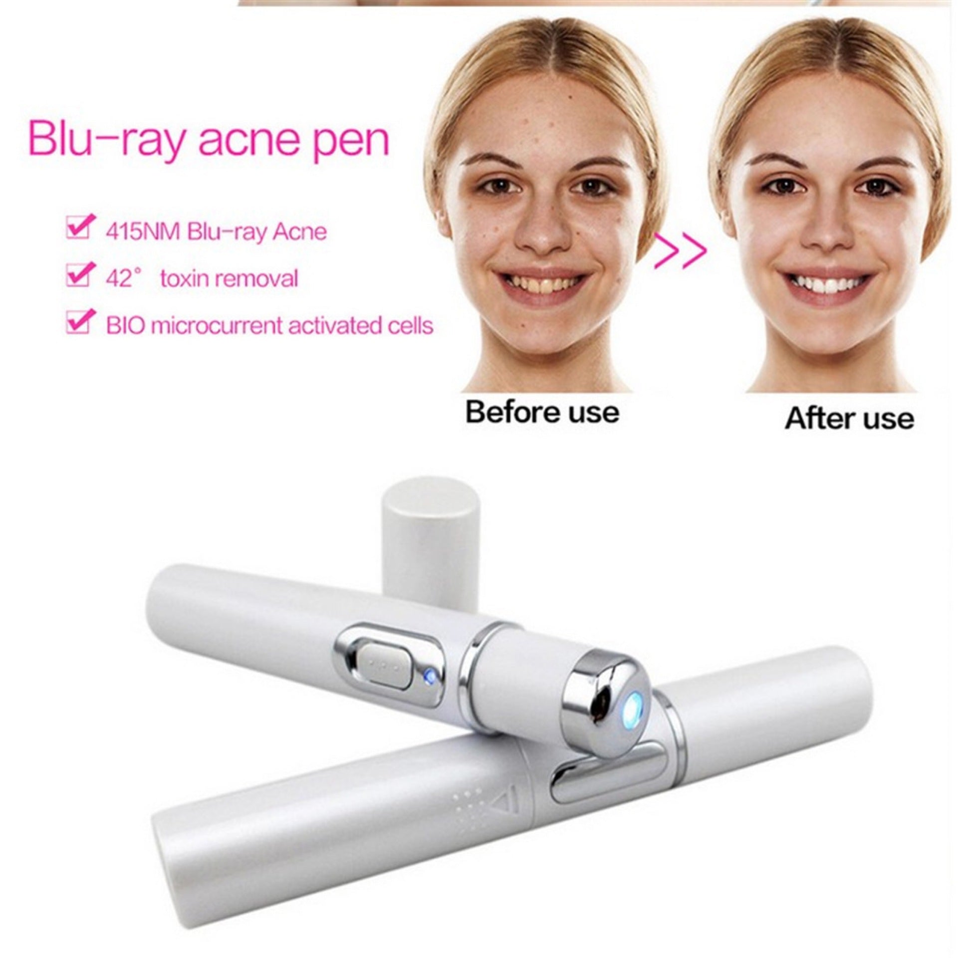 Blue Light Therapy Acne Soft Scar Wrinkle Pen Laser Removal Treatment Device