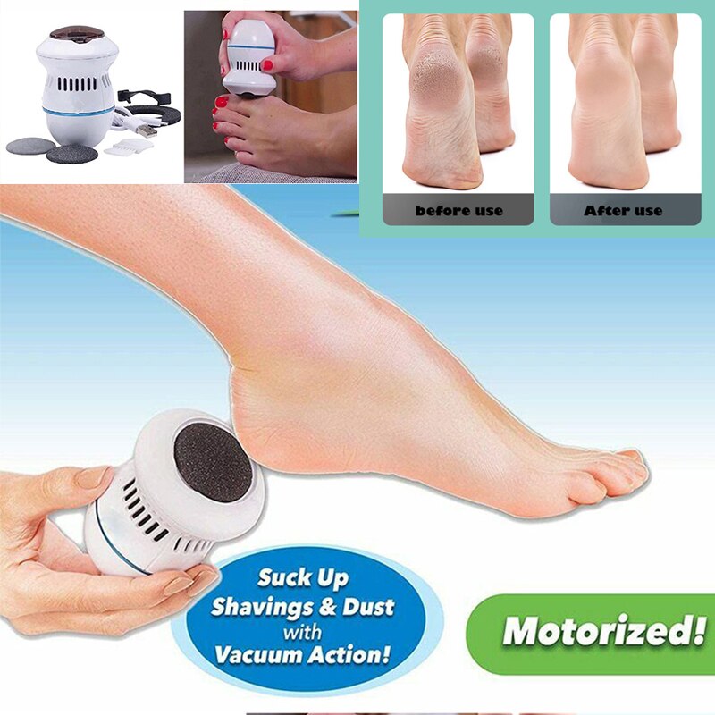 Electric Vacuum Grinder File Callus Remover