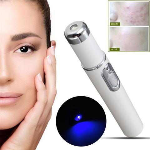 Blue Light Therapy Acne Soft Scar Wrinkle Pen Laser Removal Treatment Device