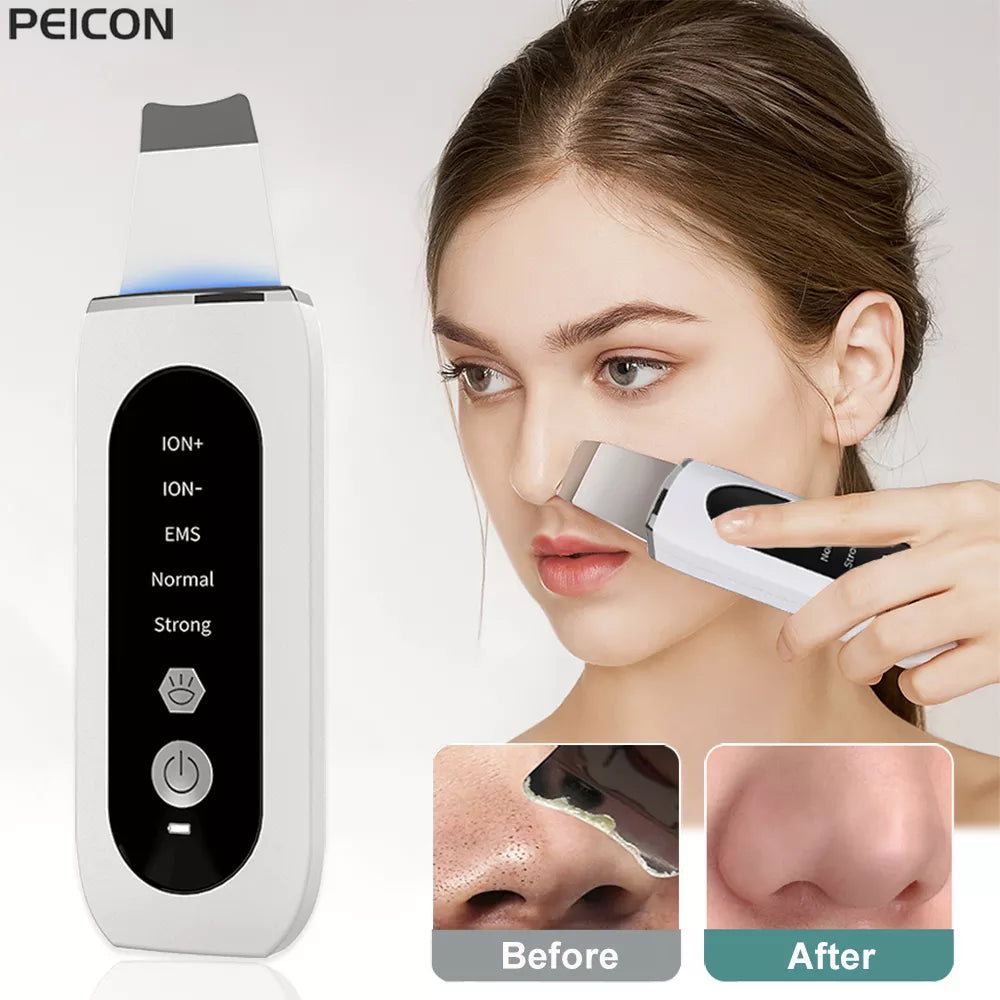 Ultrasonic Ion Skin Scrubber Blackhead Remover Deep Face Cleaning Tool