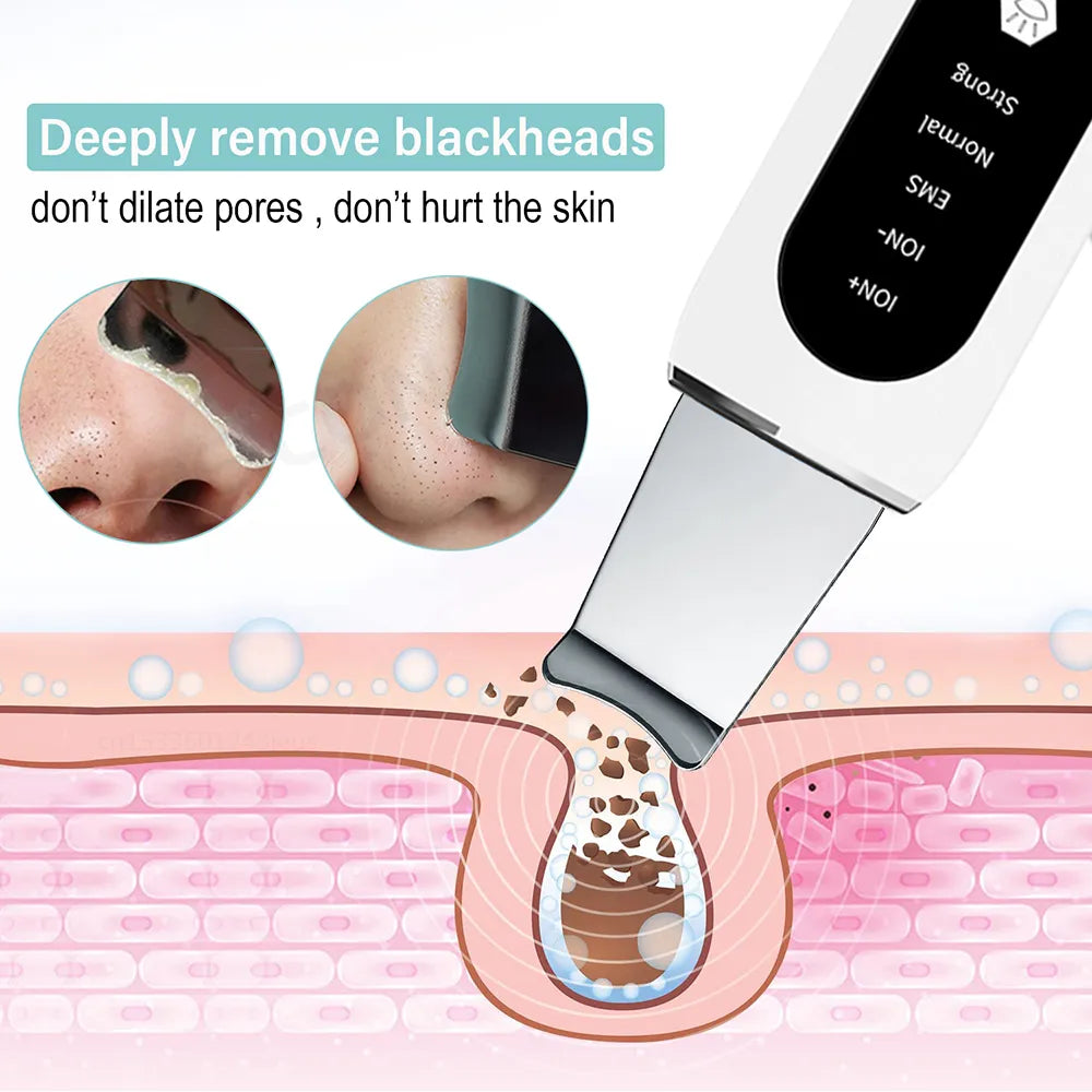 Ultrasonic Ion Skin Scrubber Blackhead Remover Deep Face Cleaning Tool